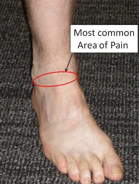 The 2024 edition of ICD-10-CM Z87. . Icd 10 for right foot pain